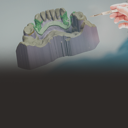 3D 컴퓨터 모의수술을 통한 임플란트 치료 계획